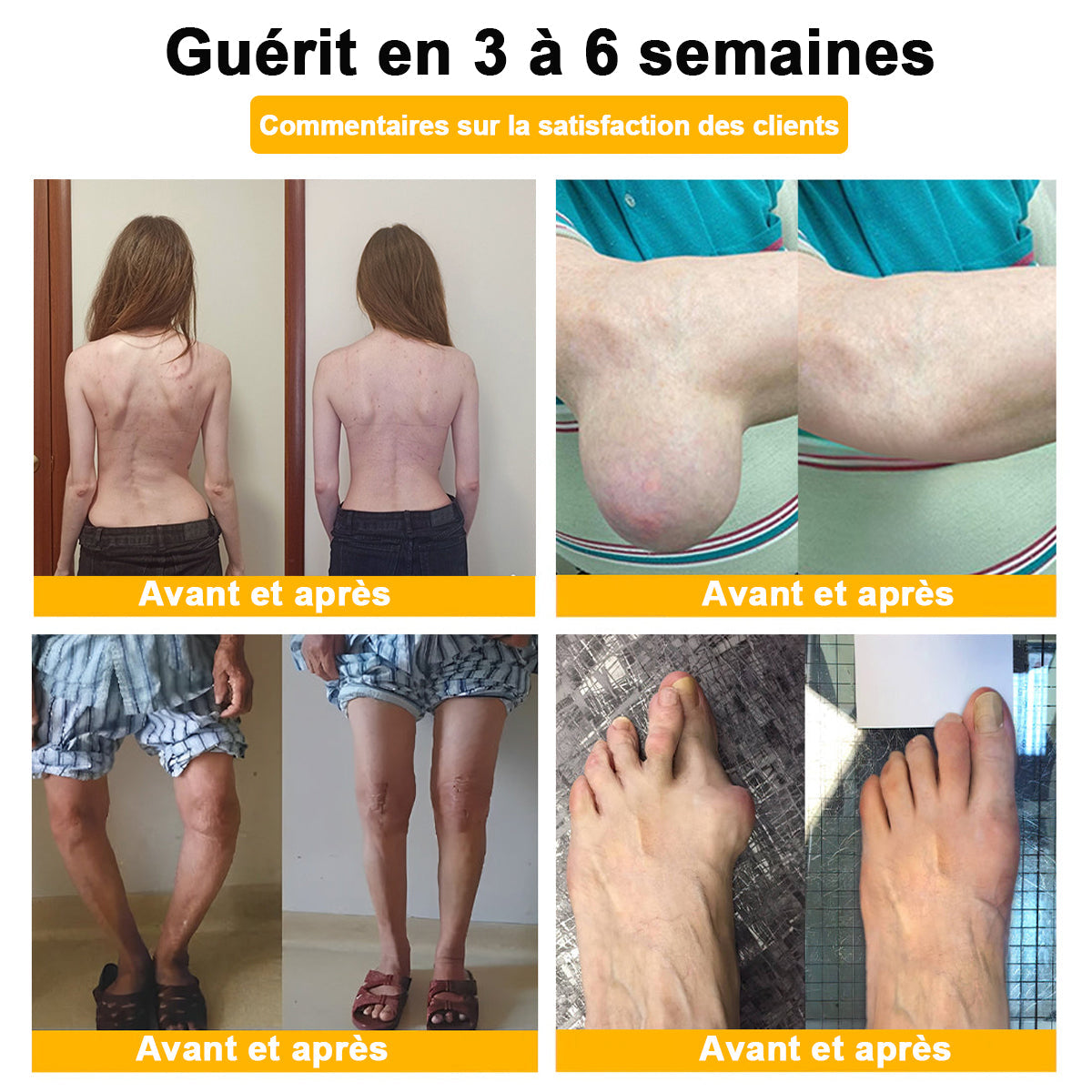 Plus que 10 packs disponibles ! 🎁🎁Nous vous offrons 50 % de réduction supplémentaire ! Si vous ratez cette occasion, vous n'aurez plus de chance l'année prochaine. ✨