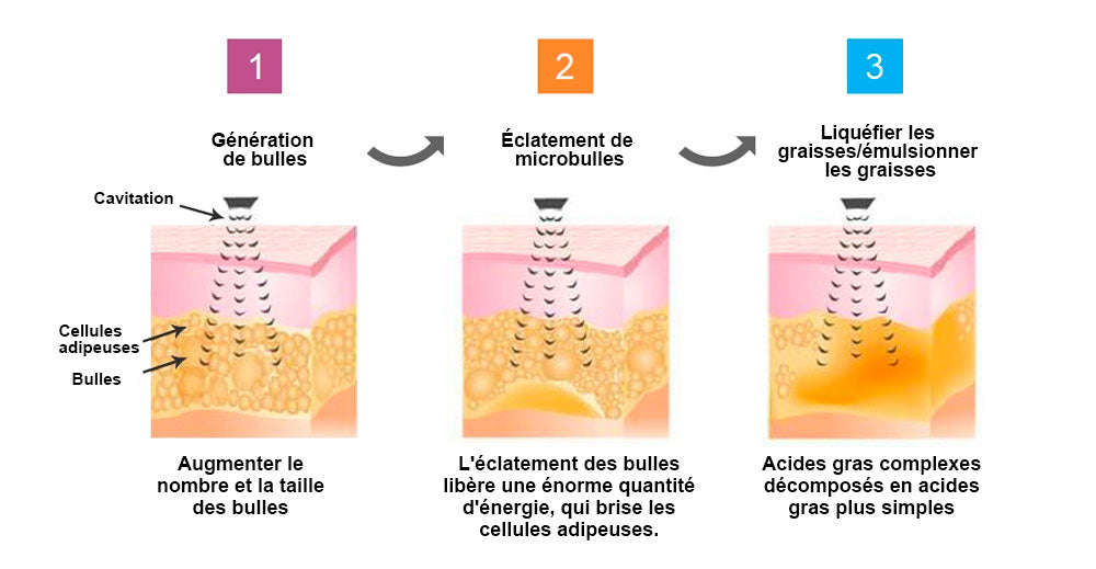 🎁Il ne reste que 5 boîtes ! Nous vous offrons une remise supplémentaire de 50 % ! Gardez la forme et restez en bonne santé. Ne ratez pas cette occasion, il n'y en aura pas une autre l'année prochaine.