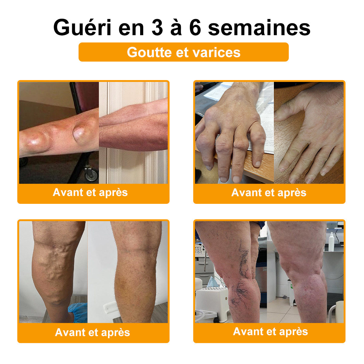Plus que 10 packs disponibles ! 🎁🎁Nous vous offrons 50 % de réduction supplémentaire ! Si vous ratez cette occasion, vous n'aurez plus de chance l'année prochaine. ✨