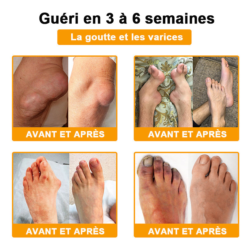 Plus que 10 packs disponibles ! 🎁🎁Nous vous offrons 50 % de réduction supplémentaire ! Si vous ratez cette occasion, vous n'aurez plus de chance l'année prochaine. ✨