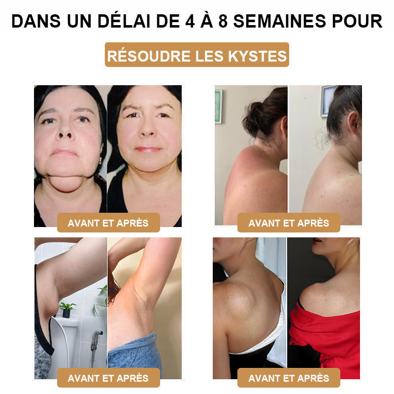 🎁Il ne reste que 5 boîtes ! Nous vous offrons une remise supplémentaire de 50 % ! Gardez la forme et restez en bonne santé. Ne ratez pas cette occasion, il n'y en aura pas une autre l'année prochaine.