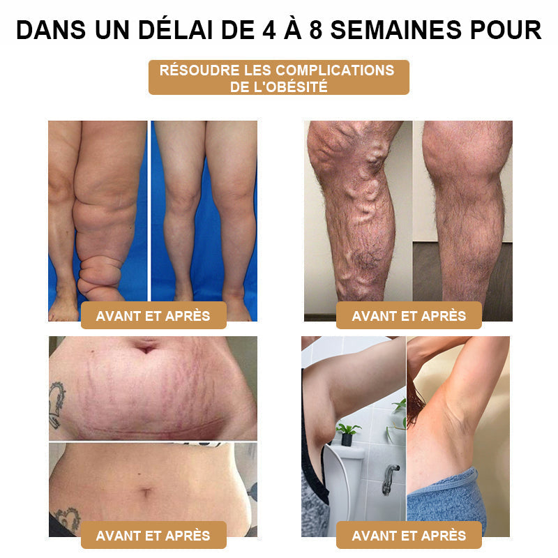 🎁Il ne reste que 5 boîtes ! Nous vous offrons une remise supplémentaire de 50 % ! Gardez la forme et restez en bonne santé. Ne ratez pas cette occasion, il n'y en aura pas une autre l'année prochaine.