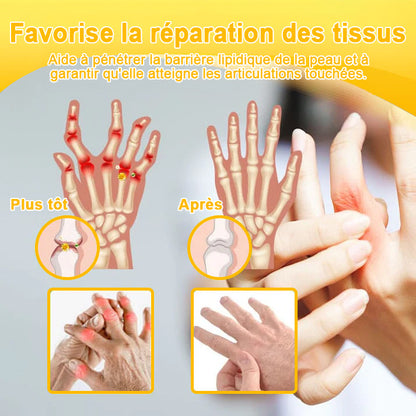 ADNOON®⚜️Crème de guérison des os et de soulagement de la douleur au Botox et venin d'abeille