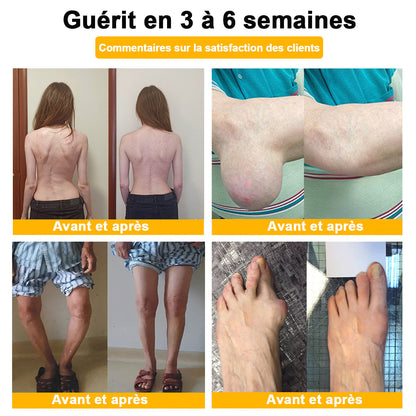 ADNOON®⚜️Crème de guérison des os et de soulagement de la douleur au Botox et venin d'abeille