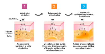 🎁Il ne reste que 5 boîtes ! Nous vous offrons une remise supplémentaire de 50 % ! Gardez la forme et restez en bonne santé. Ne ratez pas cette occasion, il n'y en aura pas une autre l'année prochaine.