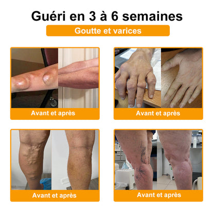 ADNOON®⚜️Crème de guérison des os et de soulagement de la douleur au Botox et venin d'abeille