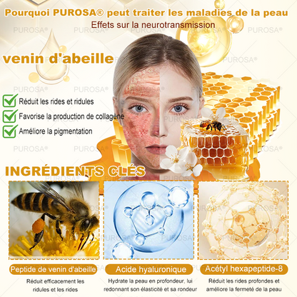 PUROSA® Crème de soin au venin d’abeille – Anti-âge, hydratation, réparation cutanée, unification du teint, traitement de l’acné et des taches brunes, élimination des verrues et des grains de beauté, soulagement du psoriasis