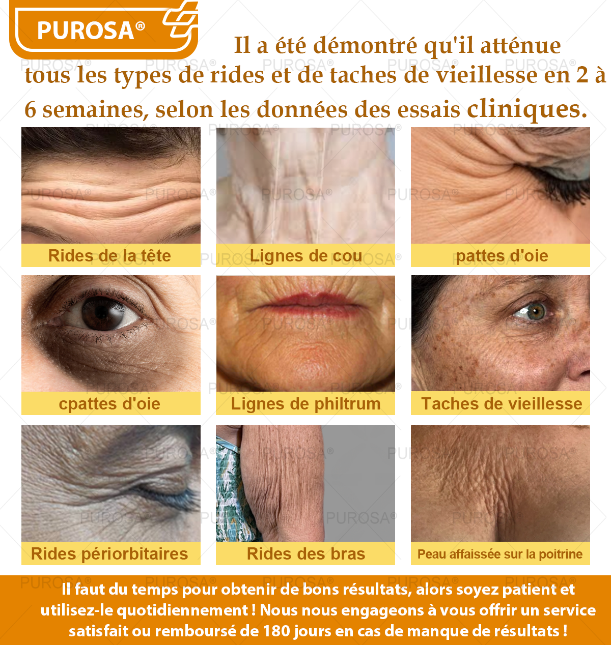 PUROSA® Crème de soin au venin d’abeille – Anti-âge, hydratation, réparation cutanée, unification du teint, traitement de l’acné et des taches brunes, élimination des verrues et des grains de beauté, soulagement du psoriasis