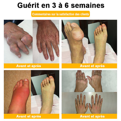ADNOON®⚜️Crème de guérison des os et de soulagement de la douleur au Botox et venin d'abeille