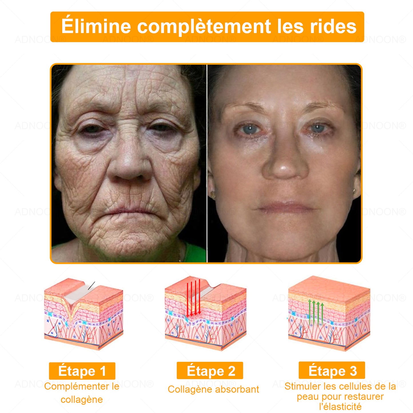 ADNOON® 🌼 Crème Multifonction 7-en-1 — Soutien professionnel fourni par la Société Française de Dermatologie (SFD) 👨‍⚕️