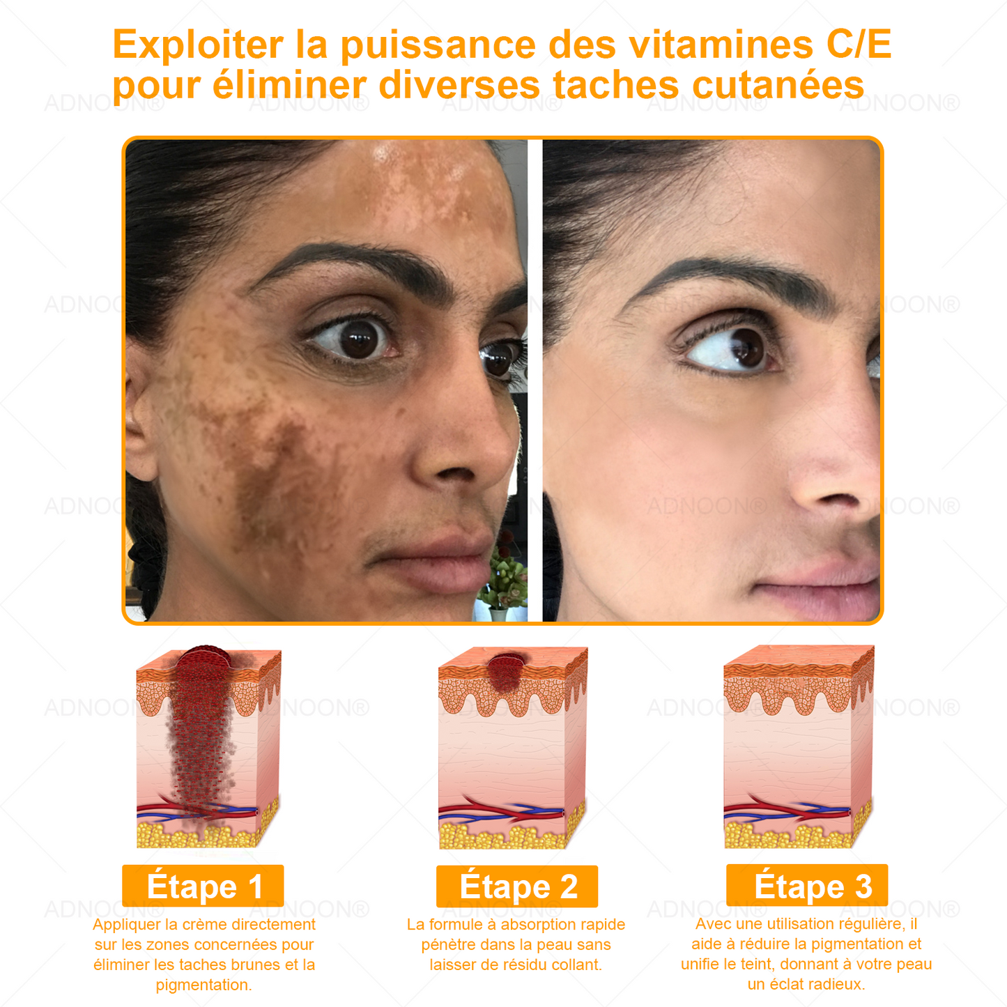 ADNOON® 🌼 Crème Multifonction 7-en-1 — Soutien professionnel fourni par la Société Française de Dermatologie (SFD) 👨‍⚕️