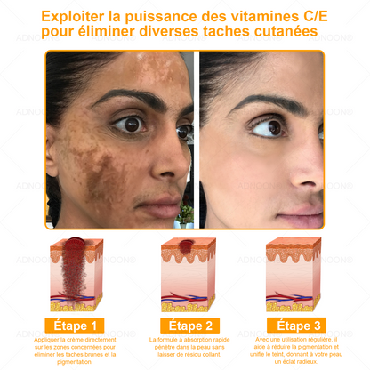 ADNOON® 🌼 Crème Multifonction 7-en-1 — Soutien professionnel fourni par la Société Française de Dermatologie (SFD) 👨‍⚕️