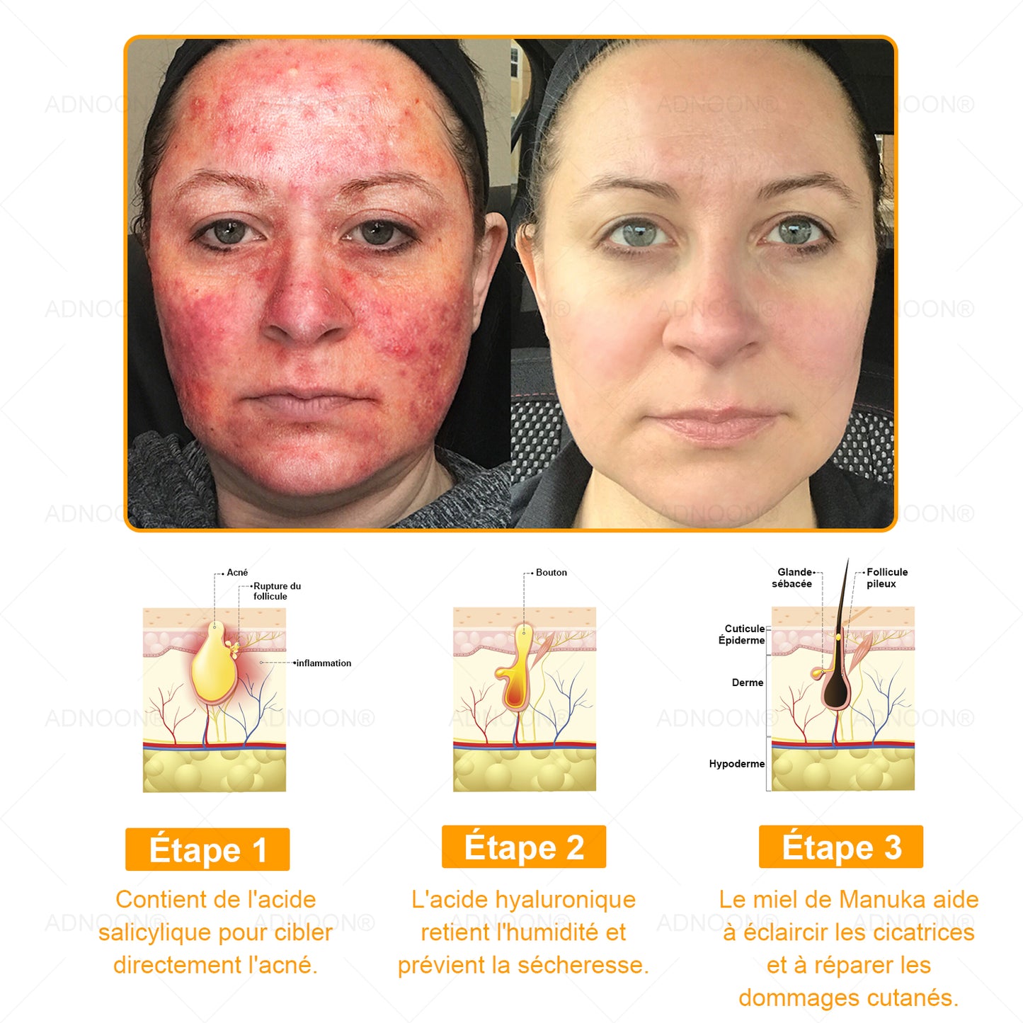 ADNOON® 🌼 Crème Multifonction 7-en-1 — Soutien professionnel fourni par la Société Française de Dermatologie (SFD) 👨‍⚕️