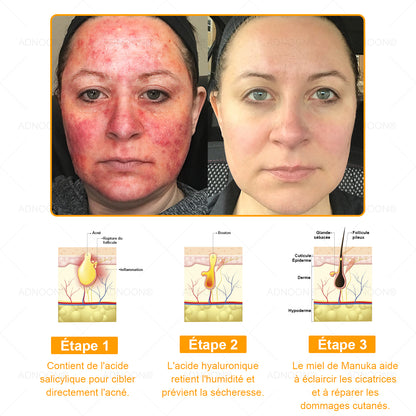 ADNOON® 🌼 Crème Multifonction 7-en-1 — Soutien professionnel fourni par la Société Française de Dermatologie (SFD) 👨‍⚕️