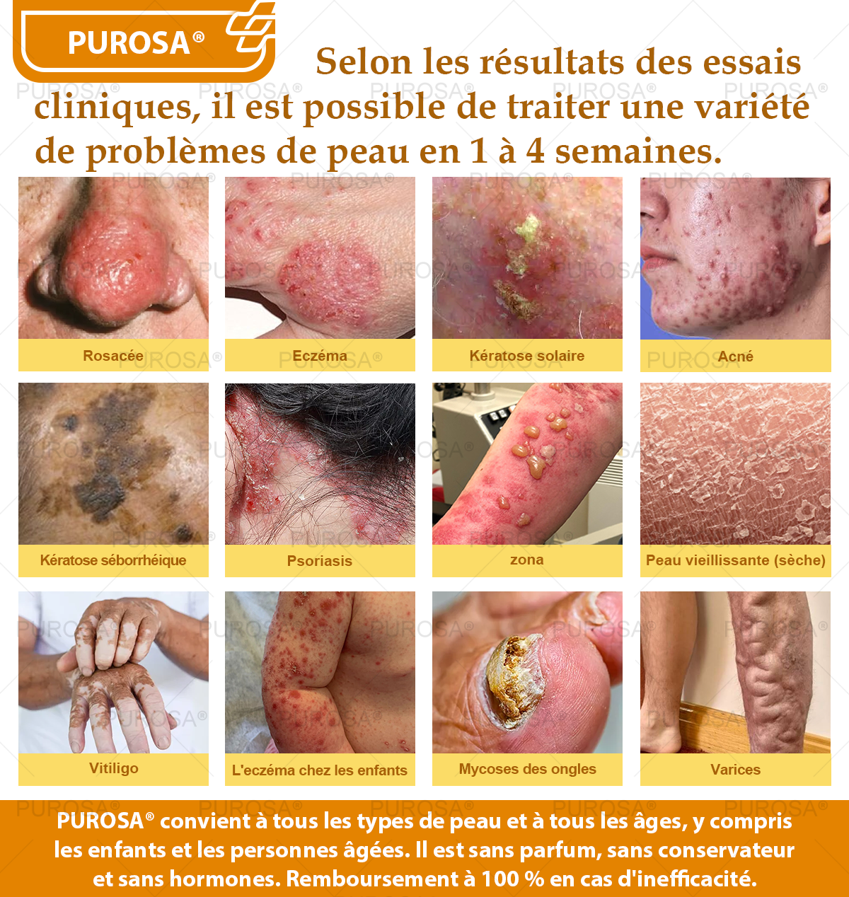 PUROSA® Crème de soin au venin d’abeille – Anti-âge, hydratation, réparation cutanée, unification du teint, traitement de l’acné et des taches brunes, élimination des verrues et des grains de beauté, soulagement du psoriasis