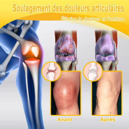 ADNOON®⚜️Crème de guérison des os et de soulagement de la douleur au Botox et venin d'abeille