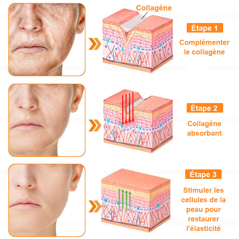 ADNOON® 🌼 Crème Multifonction 7-en-1 — Soutien professionnel fourni par la Société Française de Dermatologie (SFD) 👨‍⚕️